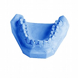 גבס סינטטי לשפיכה כחול 25קג Megadental גבס סינטטי לשפיכה כחול 25קג Megadental