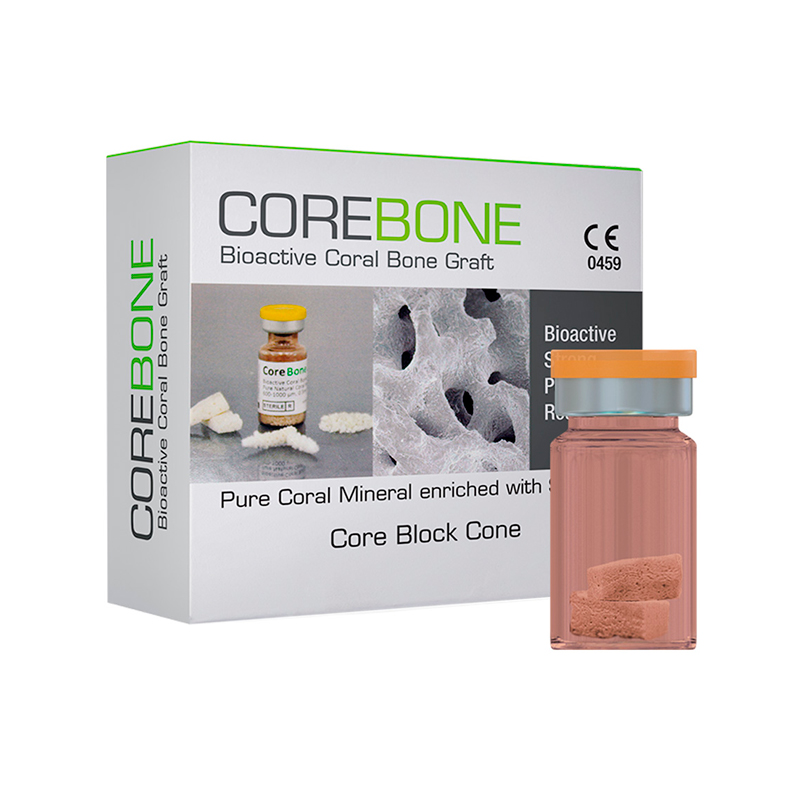 עצם אלמוגים