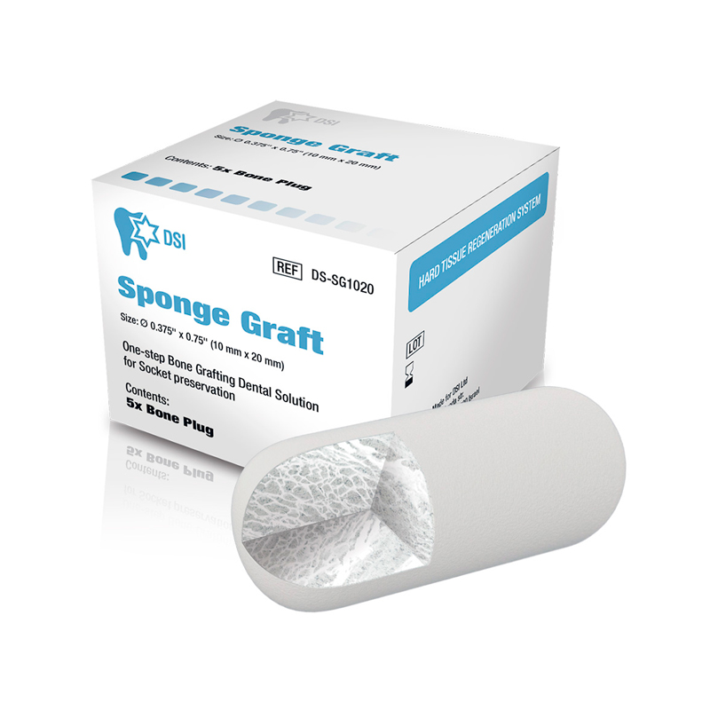 ספונג' גרפט